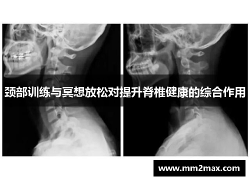 颈部训练与冥想放松对提升脊椎健康的综合作用 颈部训练与冥想放松对提升脊椎健康的综合作用